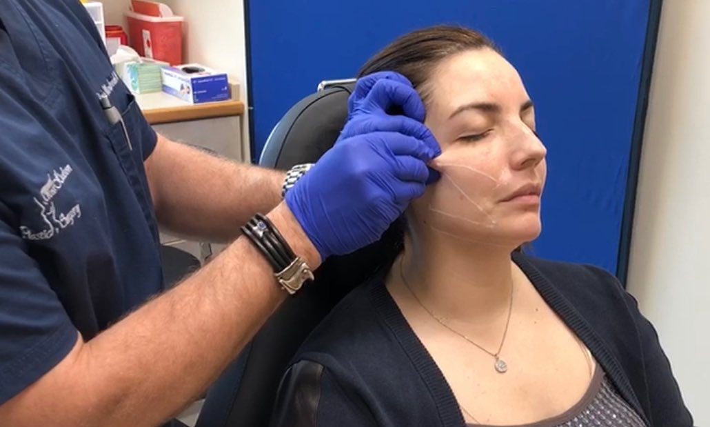 Cosmetic surgeon examining a patient's face and jawline during a facelift consultation in Fort Lee, NJ